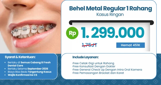 Behel Metal Regular