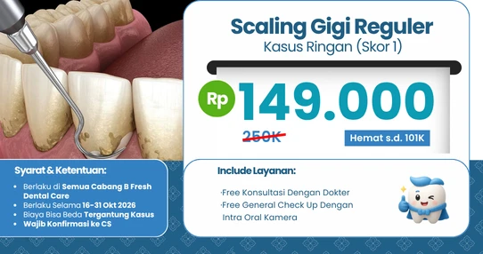 Scaling Gigi Regular (Kasus Ringan)