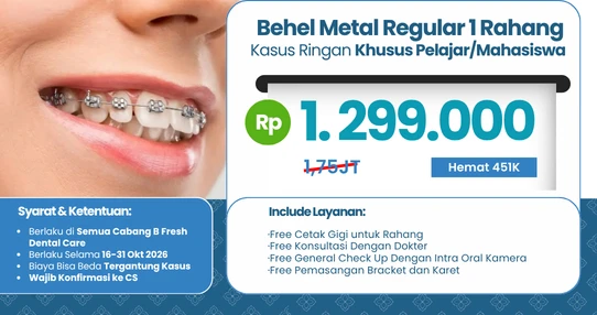 Behel Metal Regular (Pelajar)